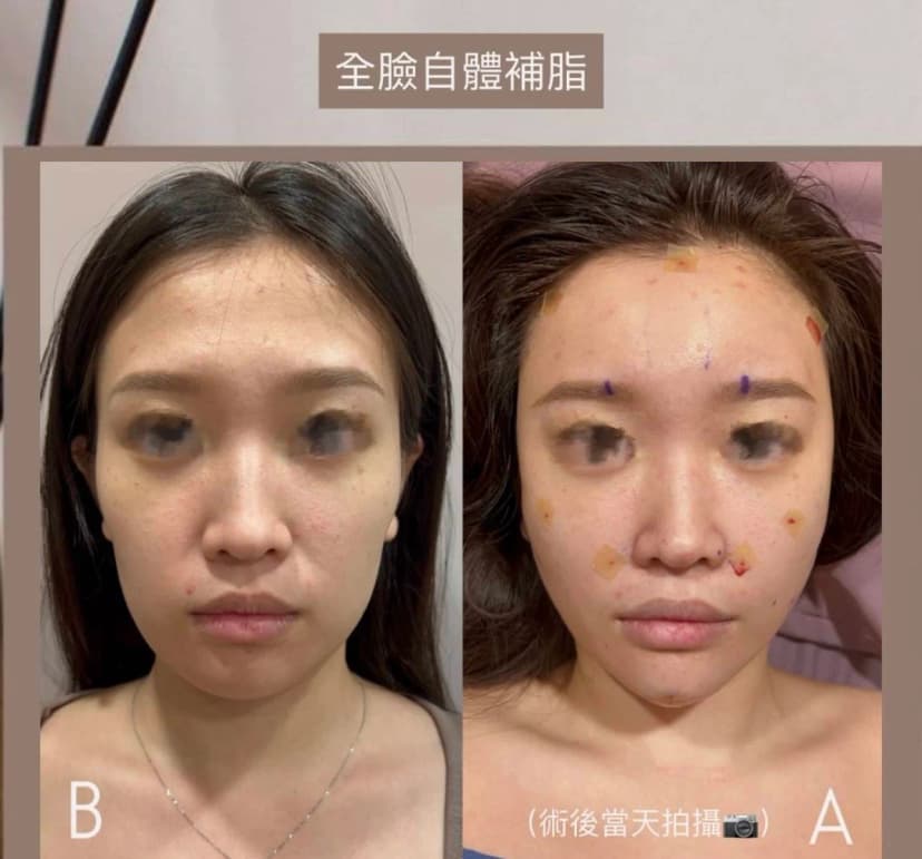 容量與全臉比例